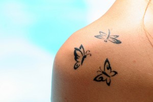 Em alguns casos a remoção da tatuagem não é completa, decorrente a intensidade e a cor.